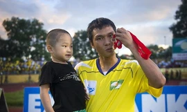 Suýt thành phế nhân, Hồng Việt vẫn rộng lượng với gã sát thủ