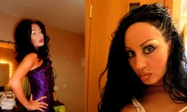 'Choáng' với cô gái trẻ 13 lần ‘dao kéo’