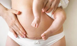 5 vấn đề về da phụ nữ thường gặp sau sinh con