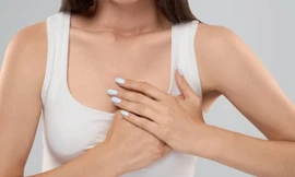 Đau vòng một trước kỳ ‘đèn đỏ’ là triệu chứng ung thư vú?