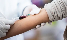 Có những xét nghiệm máu nào mà bạn không cần nhịn ăn? 