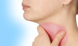 Hiểu rõ về tình trạng đau họng
