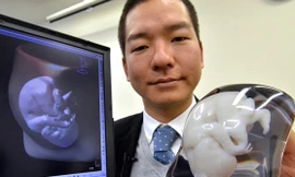 In hình bào thai bằng công nghệ 3D ở Nhật Bản