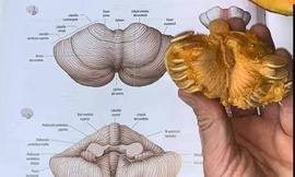 Khi sinh viên Y "học giải phẫu quá 180 phút": Nhìn bông súp lơ mà cứ ngỡ là não người!