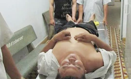 'Hiệp sĩ' bị đánh bất tỉnh khi bắt băng trộm xe