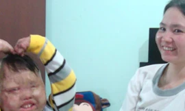 Cậu bé bị bố đốt và hành trình tìm lại tuổi thơ