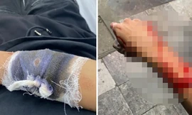 Công an Hà Nội truy lùng toán cướp gây án trước Nhà hát Lớn