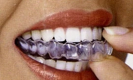 Lắp bộ răng mới nhờ máy in xương công nghệ 3D