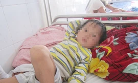 Cháu bé ba tuổi bị chó cắn gần đứt dương vật