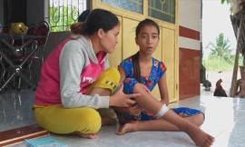 Chị Samala và con gái Mỹ Tiên vẫn còn ám ảnh về chuyện bị khỉ hoang tấn công Ảnh: Kim Hà