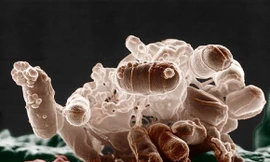 Thêm bệnh nhân nhiễm khuẩn Ecoli