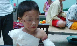 Bé trai 5 tuổi bị gấu cắn đứt 2 tay