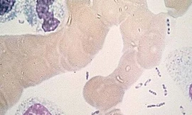 Vi khuẩn dịch hạch dưới kính hiển vi. 