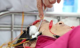 Trời rét đậm khiến nhiều người bị liệt dây thần kinh số 7. Ảnh: L.P.