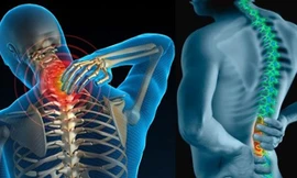 Ngủ đúng tư thế nào để tránh đau lưng và cổ?