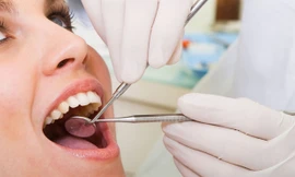 Để hạn chế những rủi ro do khi mọc răng khôn, người bệnh nên đến các cơ sở y tế để được khám và tư vấn hướng điều trị kịp thời. Ảnh minh họa