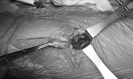 Bác sĩ mổ nối gân cho bệnh nhân. Ảnh: X.A