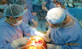 Ca phẫu thuật ghép gan cho bệnh nhi Minh Hân tại BV Nhi đồng 2. Ảnh: BVCC.