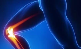 Hệ miễn dịch tấn công vào sụn khớp của chính cơ thể mình làm đẩy nhanh tiến trình thoái hóa khớp