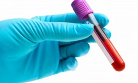 Tạo ra máu nhân tạo từ thực vật