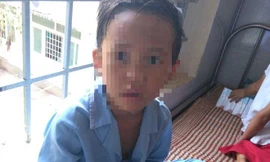 Trần tình của thầy giáo bị tố đấm học sinh 7 tuổi chảy máu mũi