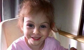 Gương mặt nhí nhảnh của Victoria trước khi bị thương. Ảnh: news.com.au 