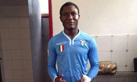 Khuôn mặt già hơn vài chục tuổi của tài năng trẻ Joseph Minala. Ảnh: Daily Mail 