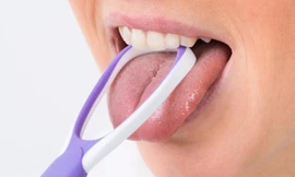 Lưỡi không được làm sạch thường xuyên ngoài việc ảnh hưởng tới vệ sinh răng miệng, làm hơi thở kém thơm tho còn gây nhiều tác hại không ngờ khác cho sức khỏe...Ảnh minh họa