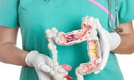 Viêm đại tràng có nhiều ổ viêm loét