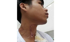 Sau khi được cấp cứu kịp thời, hiện sức khỏe anh Xanh đã ổn định và đang được chăm sóc theo dõi tại bệnh viện