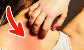 Những dấu hiệu ung thư sớm ít ai để ý 