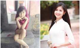 'Hot girl chân khoèo' ngày ấy bây giờ
