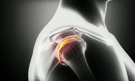 Các chuyên gia Mỹ lần đầu nuôi thành công sụn người đủ chức năng từ tế bào gốc - Ảnh: Shutterstock