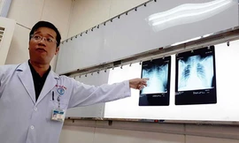 Phổi của bệnh nhân V. đã ổn định hơn sau hai ngày điều trị tại khoa ICU BV Chợ Rẫy.