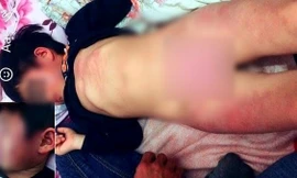 Cô giáo bị nghi đánh bé gái 4 tuổi bầm tím toàn thân