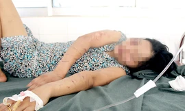 Ngoài những chấn thương trên cơ thể, chị Nguyễn Thị Kết còn bị sang chấn tâm lý.