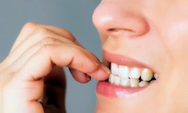 Xấu xí không phải là hậu quả duy nhất của việc cắn móng tay. Thói quen này thậm chí có thể đe dọa tính mạng của bạn.