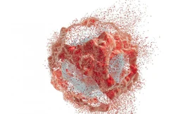 Các nhà nghiên cứu đã phát triển một loại gel có thể giúp ngăn chặn ung thư tái phát và di căn.