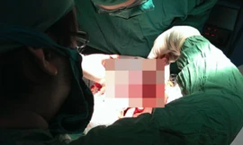 Hẹp da quy đầu là nguyên nhân hàng đầu gây ung thư dương vật. Ảnh: N.K.B.D