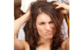 Dầu gội khô có thể gây ngứa, gàu, viêm da đầu nghiêm trọng. Ảnh: Daily Mail.