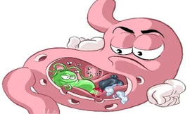 Cách hạn chế những cơn đau dạ dày