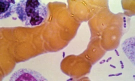 Tồn tại hơn 2.000 năm qua, dịch hạch đã gây ra 4 trận đại dịch với số tử vong khủng khiếp trong lịch sử nhân loại. Ảnh: Amazone. 