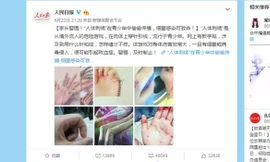 Kinh dị trào lưu thêu lên da của giới trẻ Trung Quốc