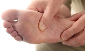 Cách trị chứng loét chân do bệnh tiểu đường