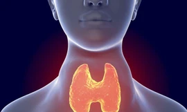 Bệnh tuyến giáp cũng là nguyên nhân gây tăng huyết áp