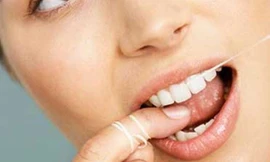 Nên xỉa răng bằng chỉ nha khoa hàng ngày.