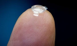 Bác sĩ Garth Webb đặt thấu kính sinh học trên ngón tay. Ảnh: Canadian Press