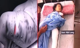 Bé gái nhập viện với thương tích nặng (nguồn: Việt Long)