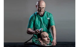 Ca cấy ghép đầu người dự tính chi phí khoảng 270 tỷ đồng.