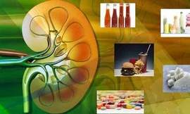 13 loại thức ăn phổ biến làm tăng nguy cơ hư thận